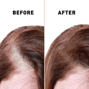 Anti Hair Loss Serum 2 In 1 Natural Hair Fall Serum Ginger And Tocopherol Hair Growth Essence Oil Hair Care Serum | Hair Loss Treatment For Men & Women