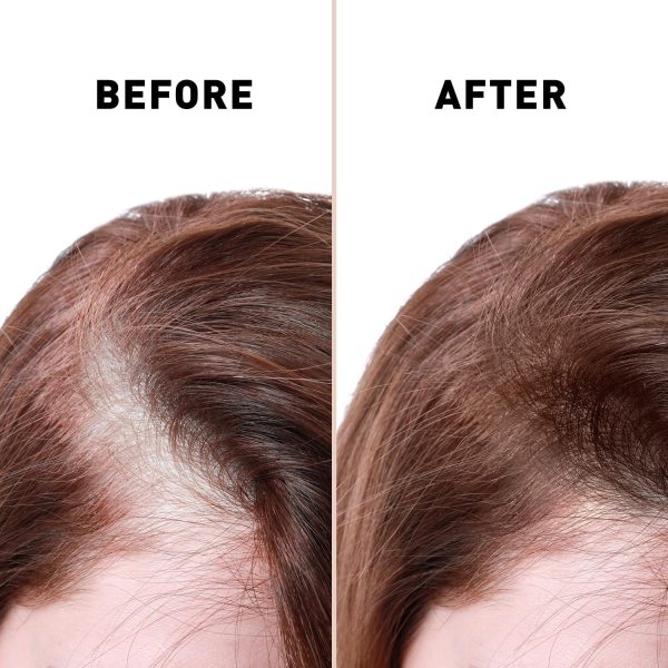 Anti Hair Loss Serum 2 In 1 Natural Hair Fall Serum Ginger And Tocopherol Hair Growth Essence Oil Hair Care Serum | Hair Loss Treatment For Men & Women