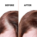 Anti Hair Loss Serum 2 In 1 Natural Hair Fall Serum Ginger And Tocopherol Hair Growth Essence Oil Hair Care Serum | Hair Loss Treatment For Men & Women