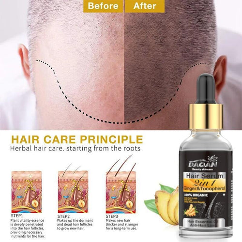 Anti Hair Loss Serum 2 In 1 Natural Hair Fall Serum Ginger And Tocopherol Hair Growth Essence Oil Hair Care Serum | Hair Loss Treatment For Men & Women