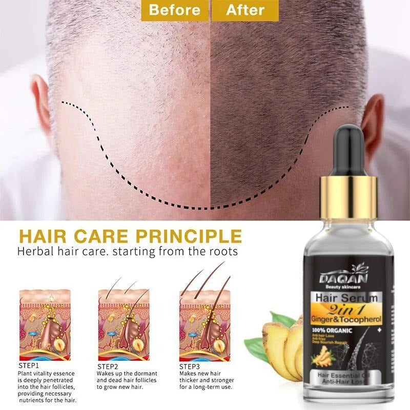 Anti Hair Loss Serum 2 In 1 Natural Hair Fall Serum Ginger And Tocopherol Hair Growth Essence Oil Hair Care Serum | Hair Loss Treatment For Men & Women