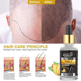 Anti Hair Loss Serum 2 In 1 Natural Hair Fall Serum Ginger And Tocopherol Hair Growth Essence Oil Hair Care Serum | Hair Loss Treatment For Men & Women